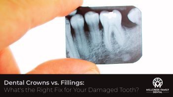 Confused about dental crowns vs fillings? Learn the best option for your damaged tooth. Get expert advice from Millcreek Family Dental in Bountiful, UT. Restore your smile!