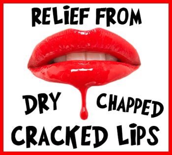 Bountiful dentist, Dr. Baird at Millcreek Family Dental, tells you how to relieve your dry, chapped, and cracked lips!