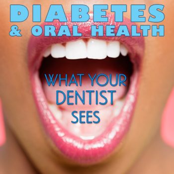 Bountiful dentist, Dr. Anthony Baird at Millcreek Family Dental, discusses the side effects of diabetes and how it affects your oral health.