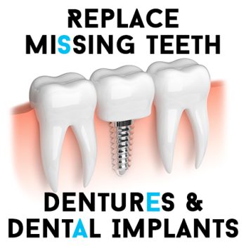 Bountiful dentist, Dr. Anthony Baird at Millcreek Family Dental, tells patients about the benefits of replacing missing teeth with dentures and dental implants.