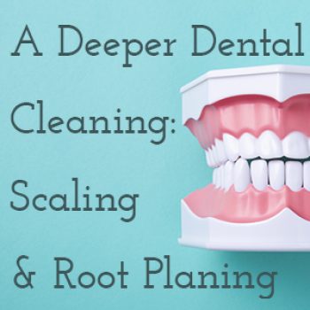 Bountiful dentist, Dr. Anthony Baird at Millcreek Family Dental tells patients about what scaling and root planing is and why it might be part of your treatment plan.